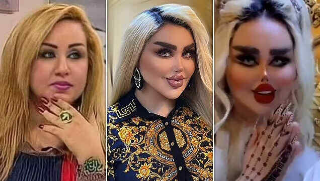 Afanyiwa surgery mara 43 ili afanane na Barbie Dolls